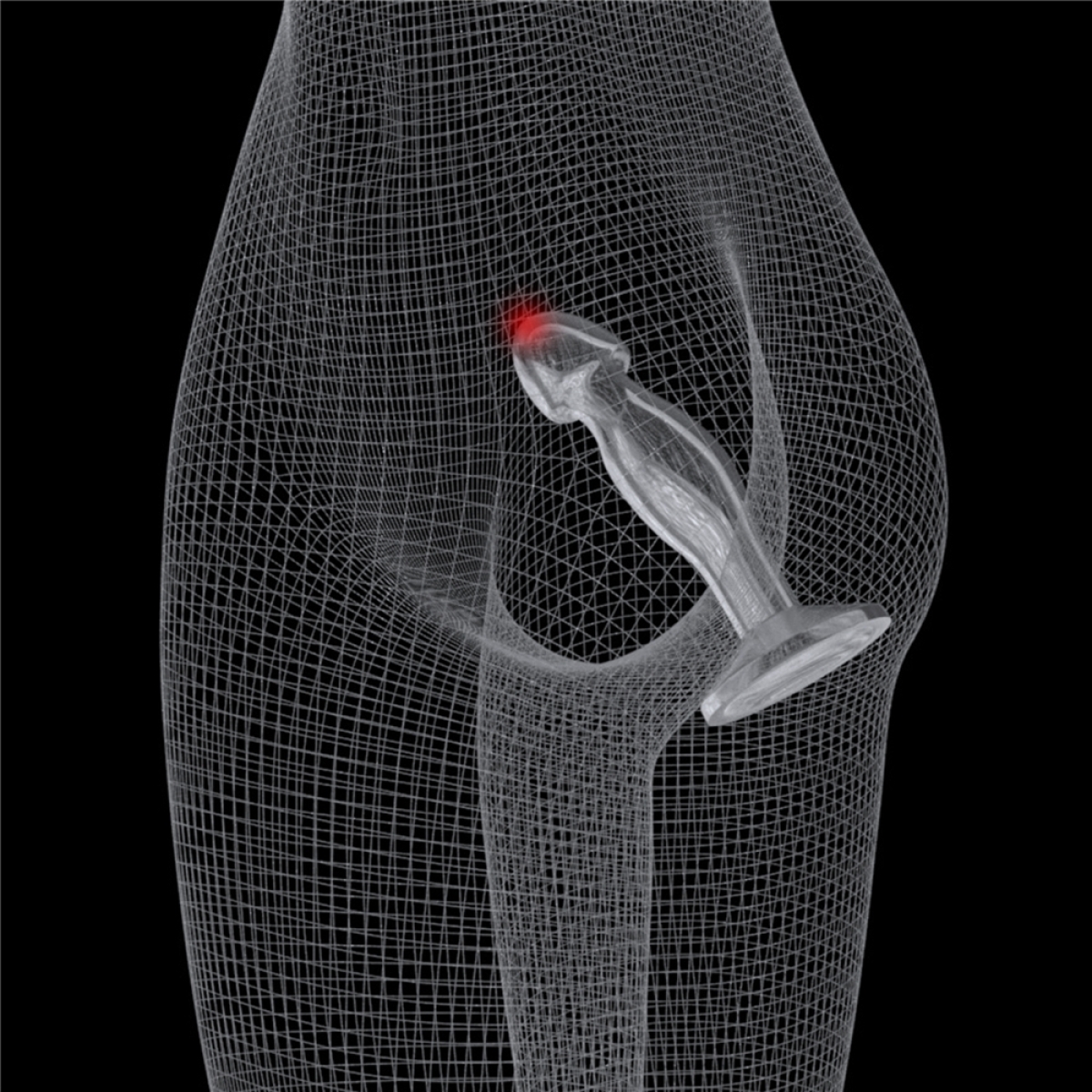 plug prostatique flawless 14 x 4cm 8