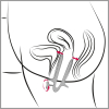 speculum ass view 105 cm ouverture maximale 10cm 6