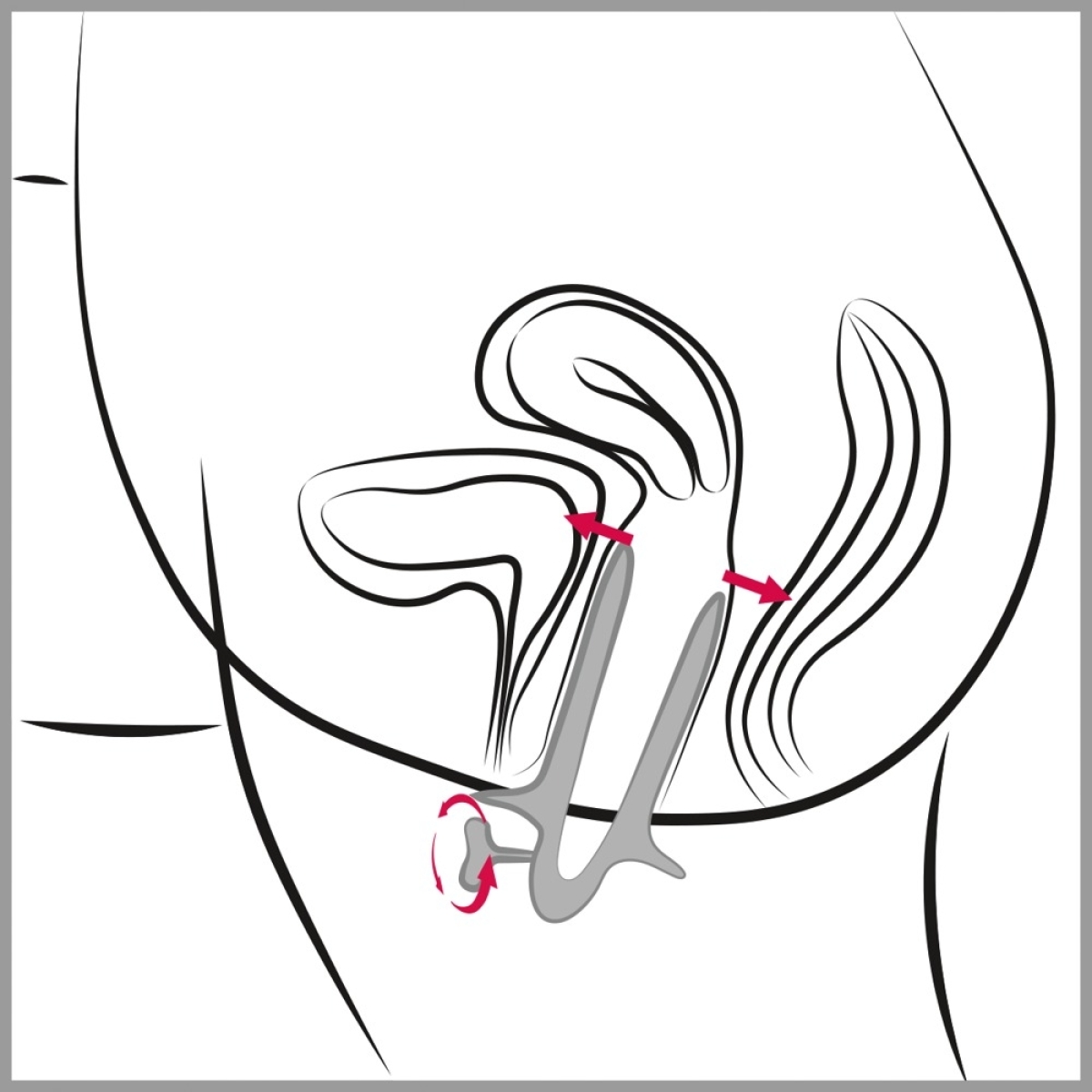 speculum ass view 105 cm ouverture maximale 10cm 6