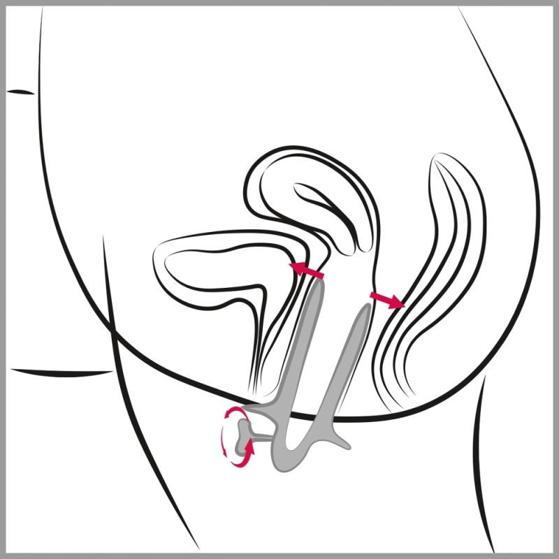 speculum ass view 105 cm ouverture maximale 10cm 6
