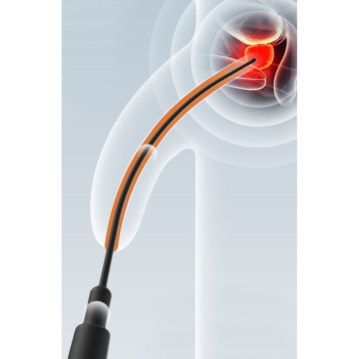 tige d uretre vibrante lexia 15 cm diametre 25mm 2